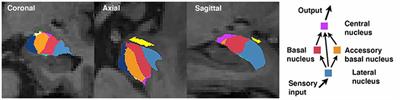 Amygdala Nuclei Volumes Are Selectively Associated With Social Network Size in Homeless and Precariously Housed Persons